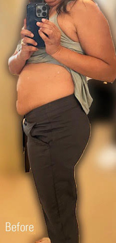 Before Image: Weight Loss - left-side