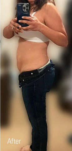 After Image: Weight Loss - left-side