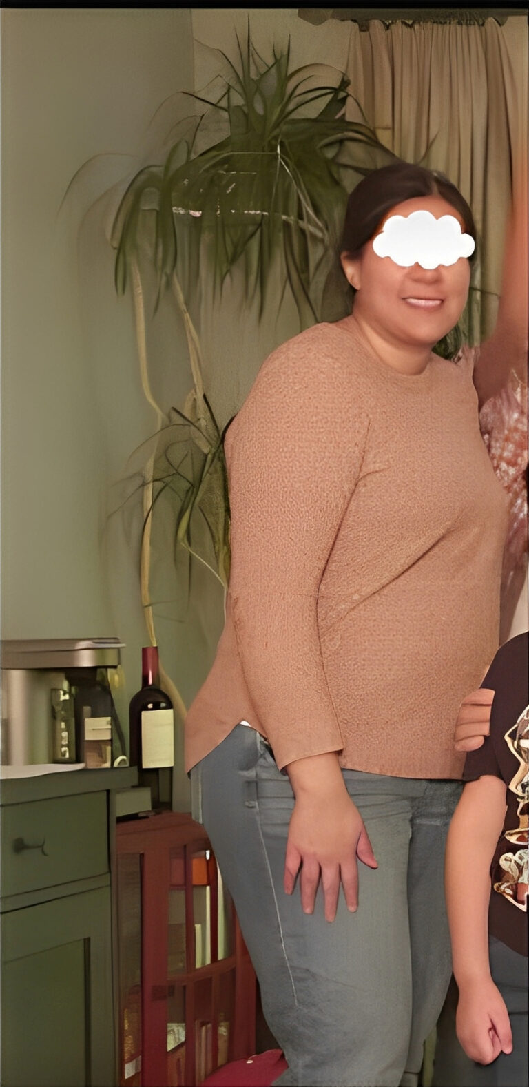 Before Image: Weight Loss - front