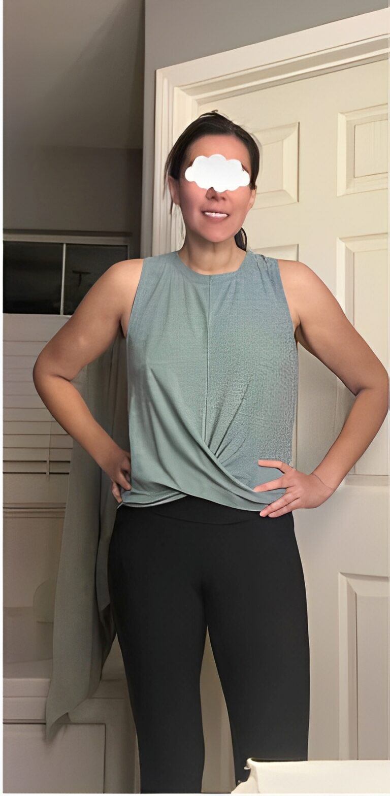 After Image: Weight Loss - front