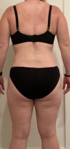 Before Image: Weight Loss