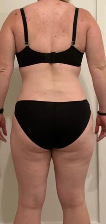Before Image: Weight Loss - back