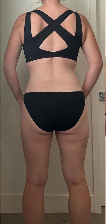 After Image: Weight Loss - back